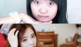 爆料小姨整容视频,揭秘网红级蜕变过程